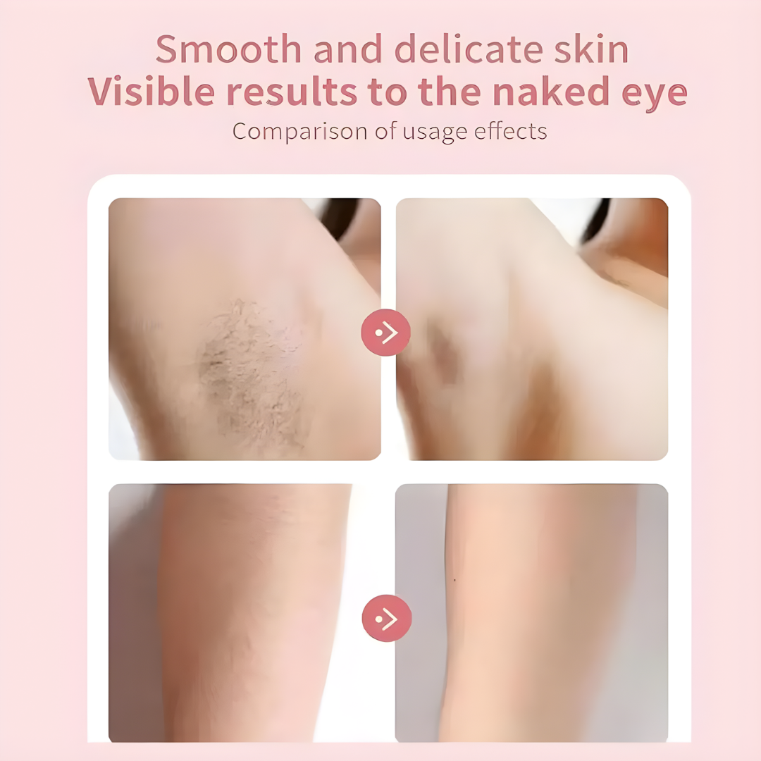 HairRemover: Genopladelig Epilator Smertefri Elektrisk Hår Fjernelse Enhed