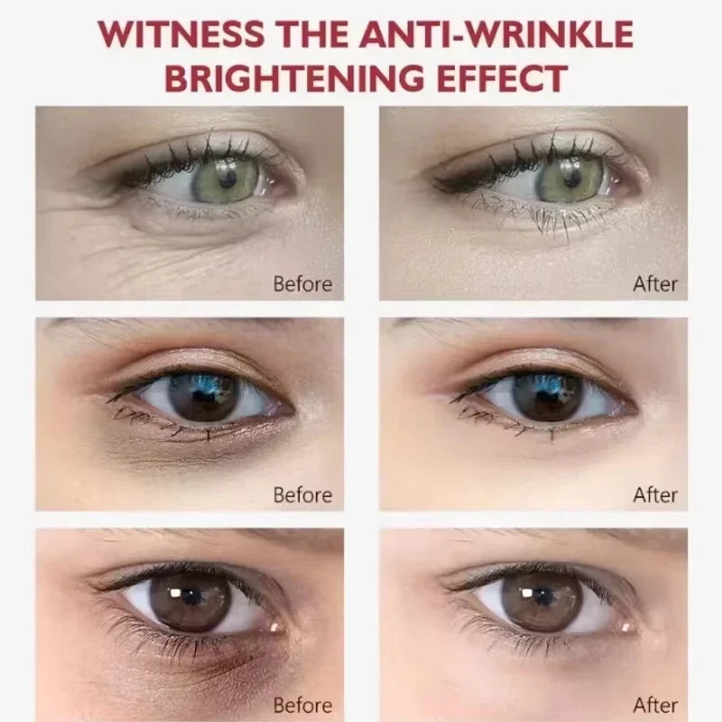 EyeCream 1+1 GRATIS: Hydrerende Opstrammende Anti-Mørke Rande Øjen Creme Serum