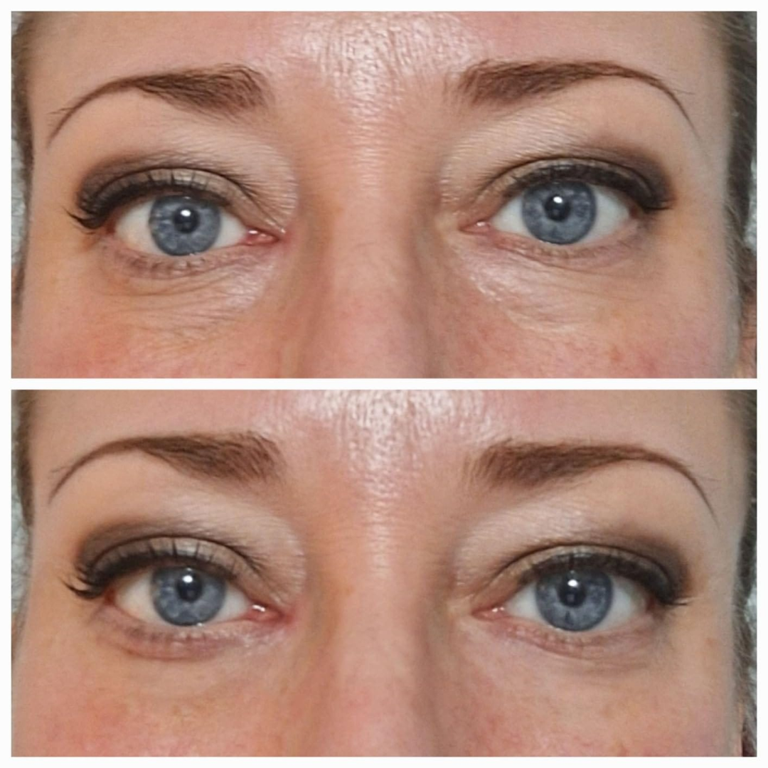 EyeCream 1+1 GRATIS: Hydrerende Opstrammende Anti-Mørke Rande Øjen Creme Serum