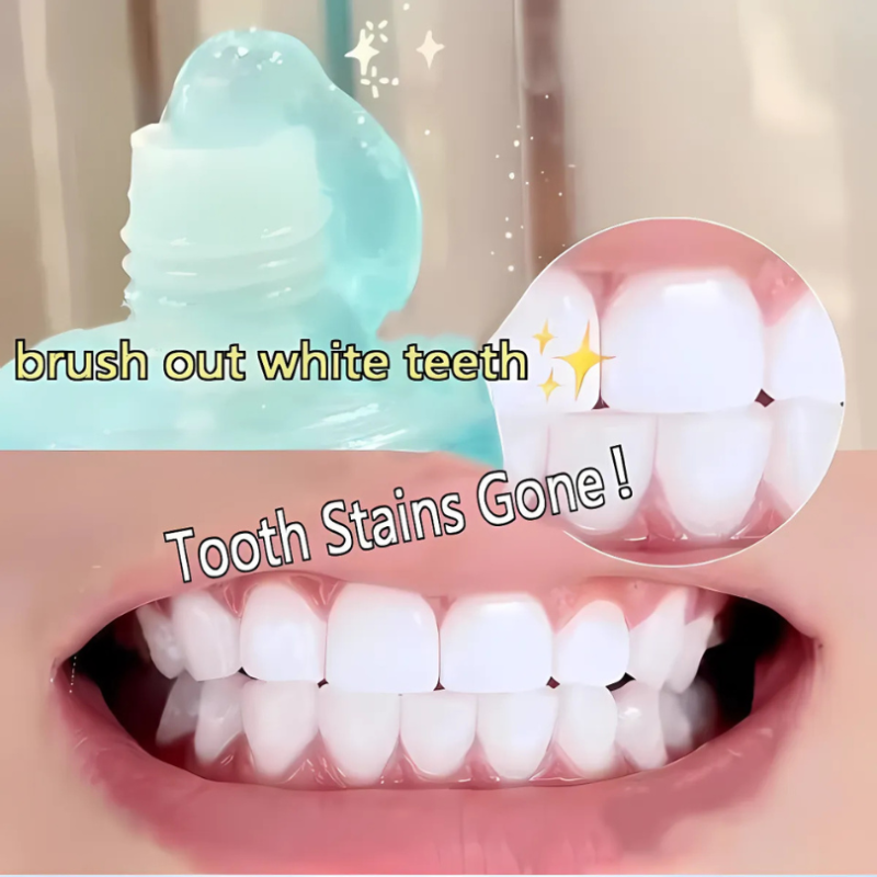 WhiteningToothpaste 1+1 GRATIS: Niacinamid-Tandpasta Til Blegning Og Fjernelse Af Pletter