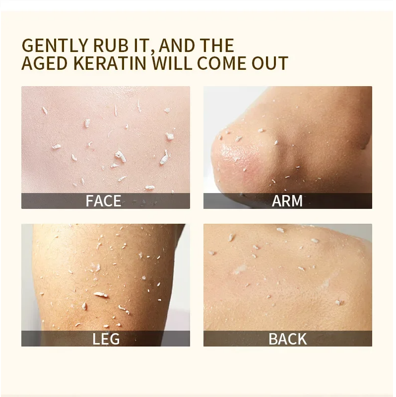 ExfoliatingGel 1+1 GRATIS: Orange Eksfolierende Gel Blid Død Hud Fjerner