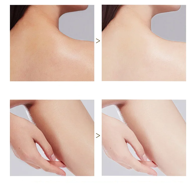 ExfoliatingGel 1+1 GRATIS: Orange Eksfolierende Gel Blid Død Hud Fjerner