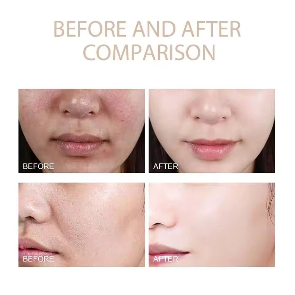 ExfoliatingSerum 1+1 GRATIS: Nem At Bruge Blød Eksfolierende Ampul Til Sensitiv Hud