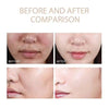 ExfoliatingSerum 1+1 GRATIS: Nem At Bruge Blød Eksfolierende Ampul Til Sensitiv Hud